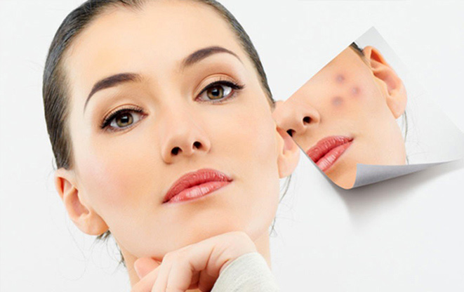 Trị tàn nhang tận gốc