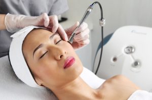 Giá điều trị nám bằng laser