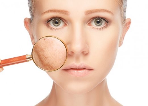 Trị nám bằng laser ở đâu tốt nhất