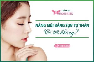 Nâng mũi bằng sụn tự thân có tốt không