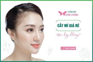 cắt mí mắt giá rẻ