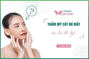 cắt mí mắt bao lâu thì bình thường