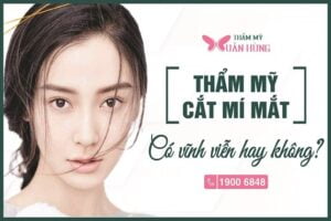 cắt mí mắt có được vĩnh viễn không