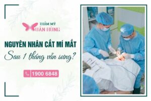 cắt mí mắt sau 1 tháng vẫn sưng