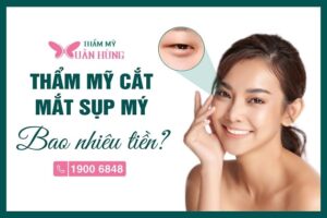 cắt mắt sụp mí bao nhiêu tiền