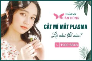 cắt mí mắt Plasma