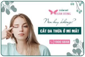 có nên cắt da thừa mí mắt không