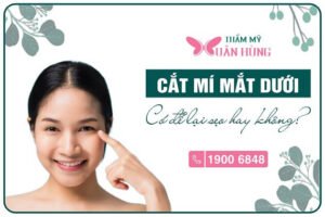 cắt mí dưới có để lại sẹo không