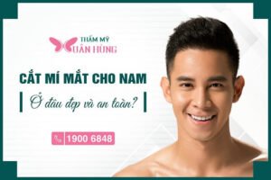 cắt mí mắt nam