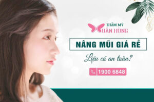 Nâng mũi giá rẻ