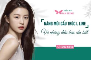 Nâng mũi cấu trúc L line nào