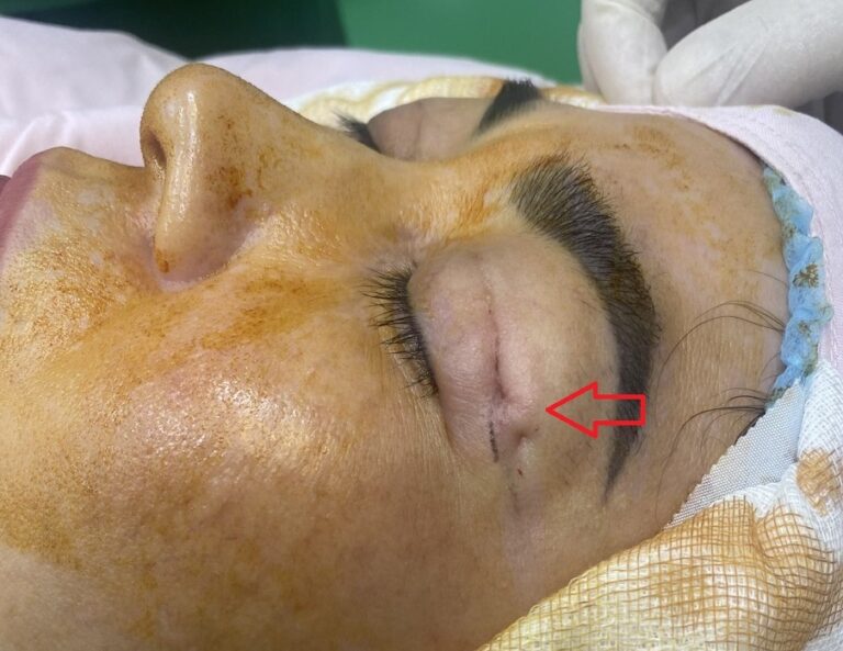 thẩm mỹ hỏng