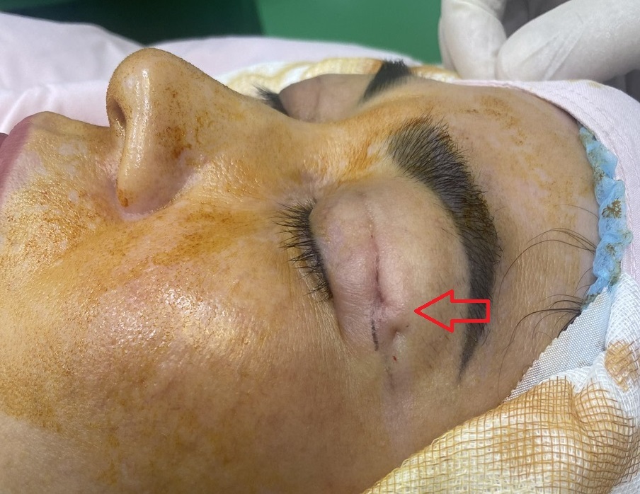 thẩm mỹ hỏng