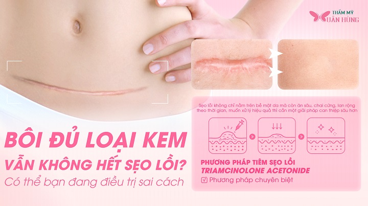 điều trị sẹo lồi