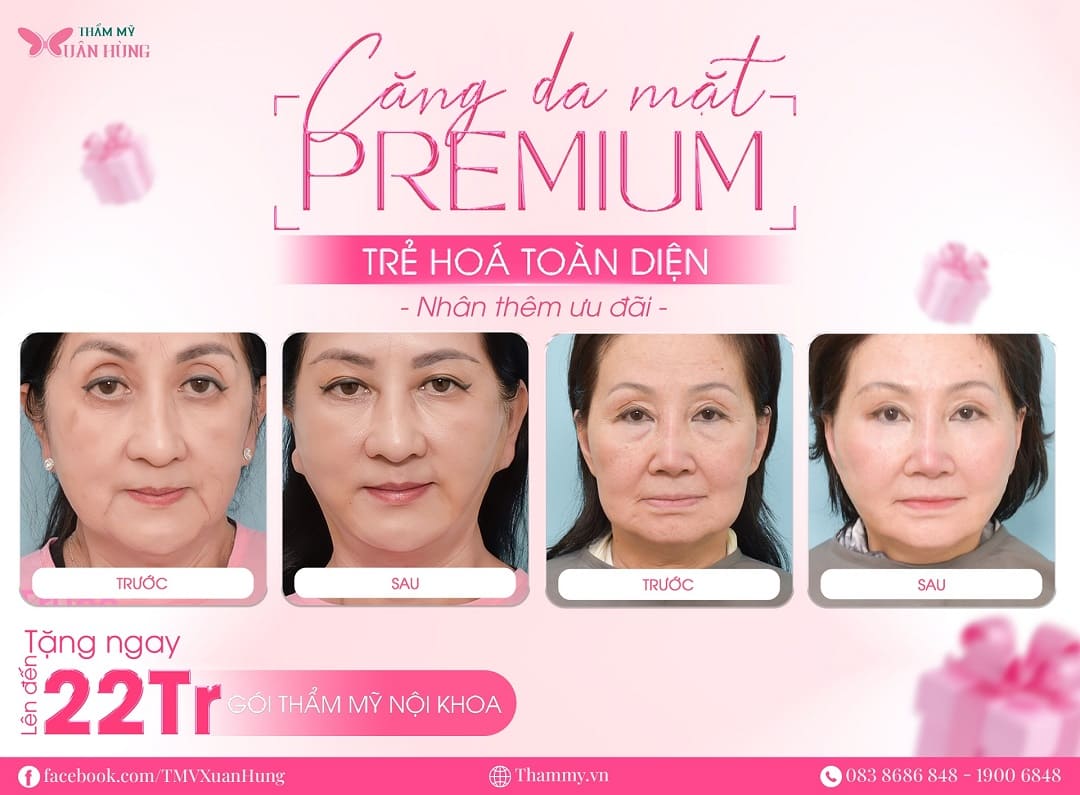 khuyến mãi căng da mặt