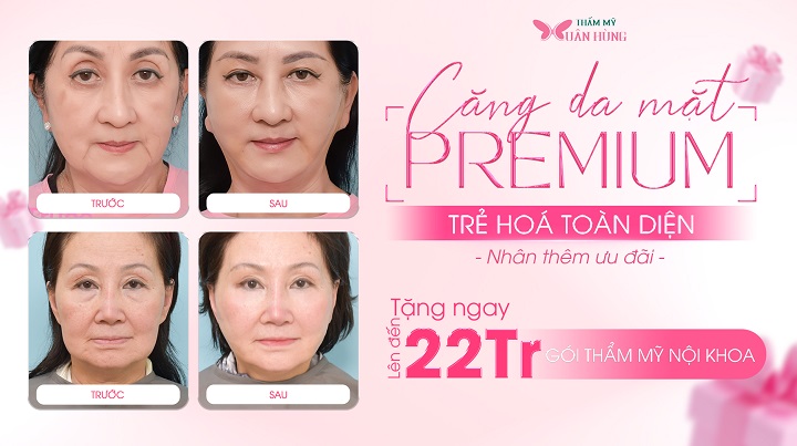 phẫu thuật căng da mặt premium