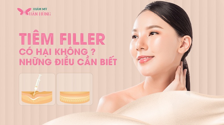 tiêm filler cằm