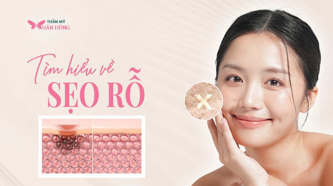 sẹo rỗ